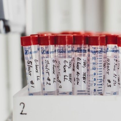 Test Tube, Can, Tin